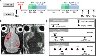 Diffusion Tensor Imaging and Chemical Exchange Saturation Transfer MRI Evaluation on the Long-Term Effects of Pulsed Focused Ultrasound and Microbubbles Blood Brain Barrier Opening in the Rat